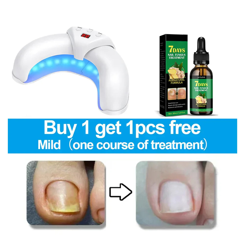 Appareil de traitement rapide au laser pour ongles - Huile réparatrice OFFERTE