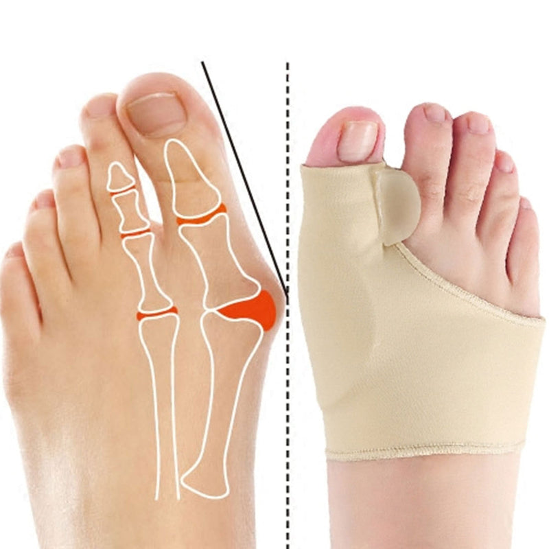 Correcteur orthopédique pour Hallux Valgus (Oignon)